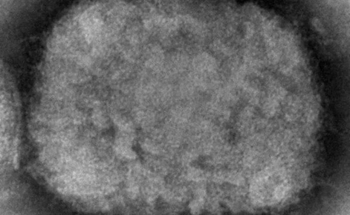 Alberta’s chief medical officer of health confirms province’s first monkeypox case