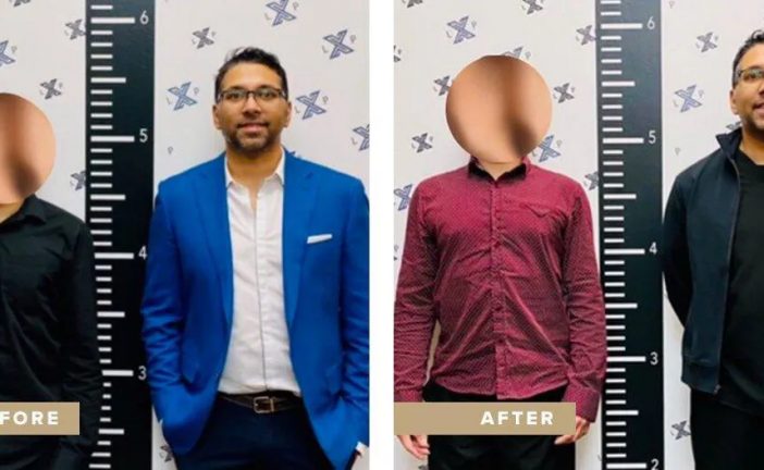 Height surgery is a booming trend in Canada, especially among men. Is cosmetic limb lengthening the new BBL?