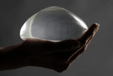 Canada’s mulling a national breast implant registry, years after a Star investigation revealed health risks